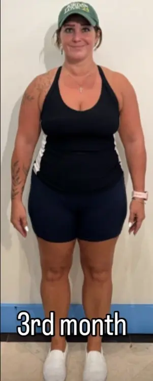 The same client’s front view at Month 3